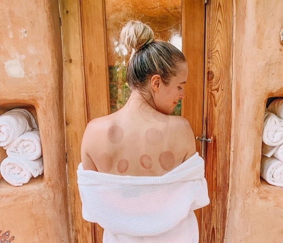 A woman covered in a towel, displaying brown spots on her back, within a tranquil luxury health spa atmosphere.