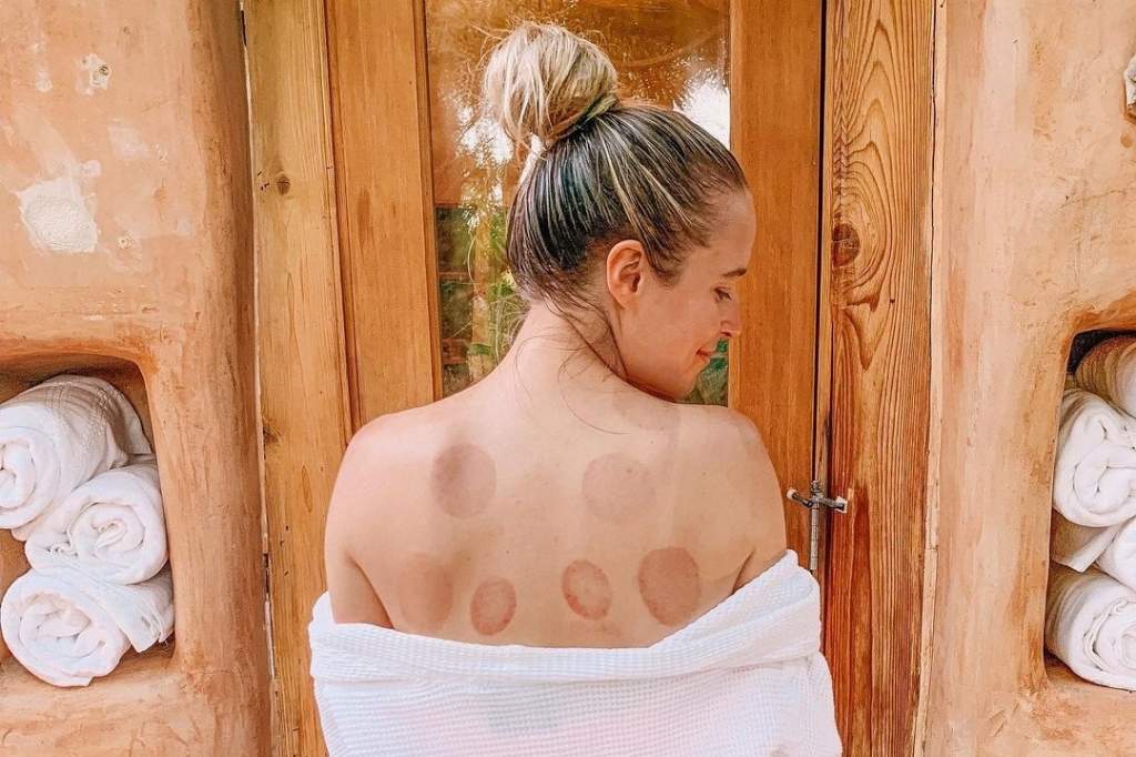 California health spa retreat featuring relaxing cupping therapy at We Care Spa